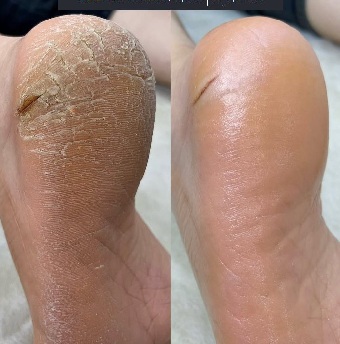 Pedicure em tom nude